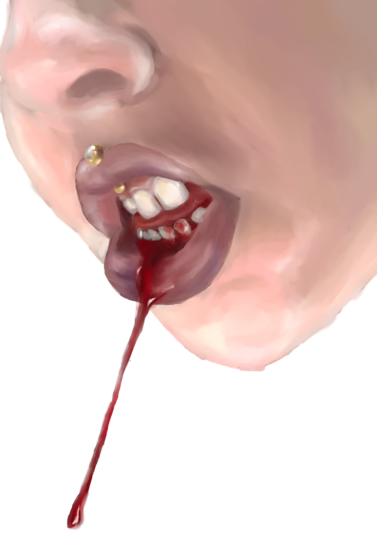 A face on an angle with bloody gums, with a drop of blood falling out of the mouth
